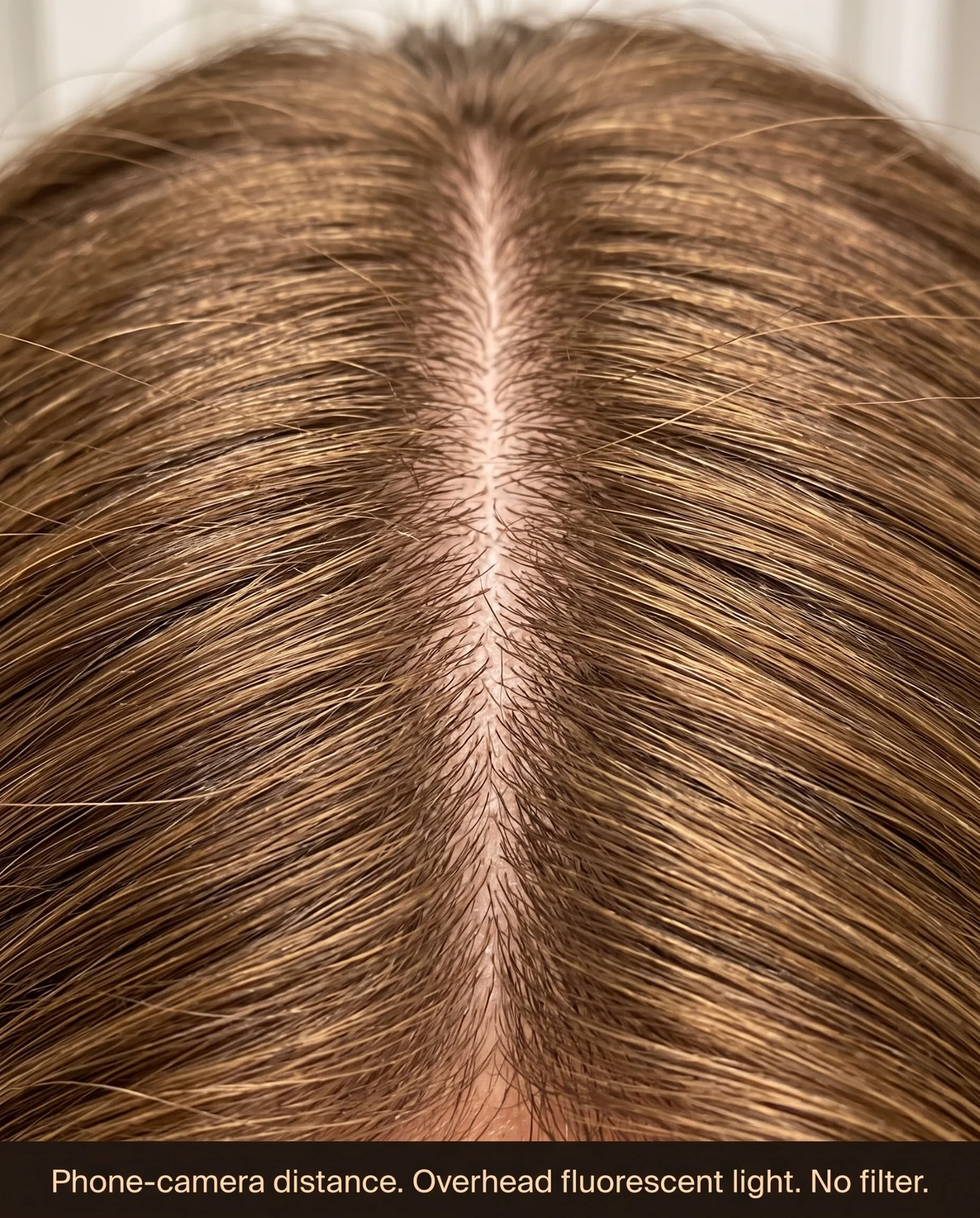 Close-up under direct overhead light — phone-camera distance