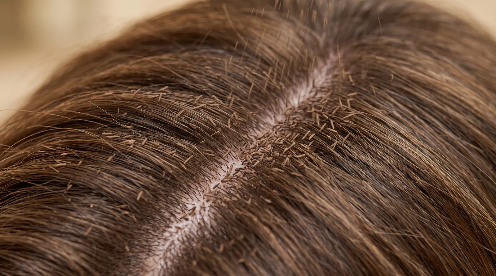 BUILD — fibers landing around existing strands